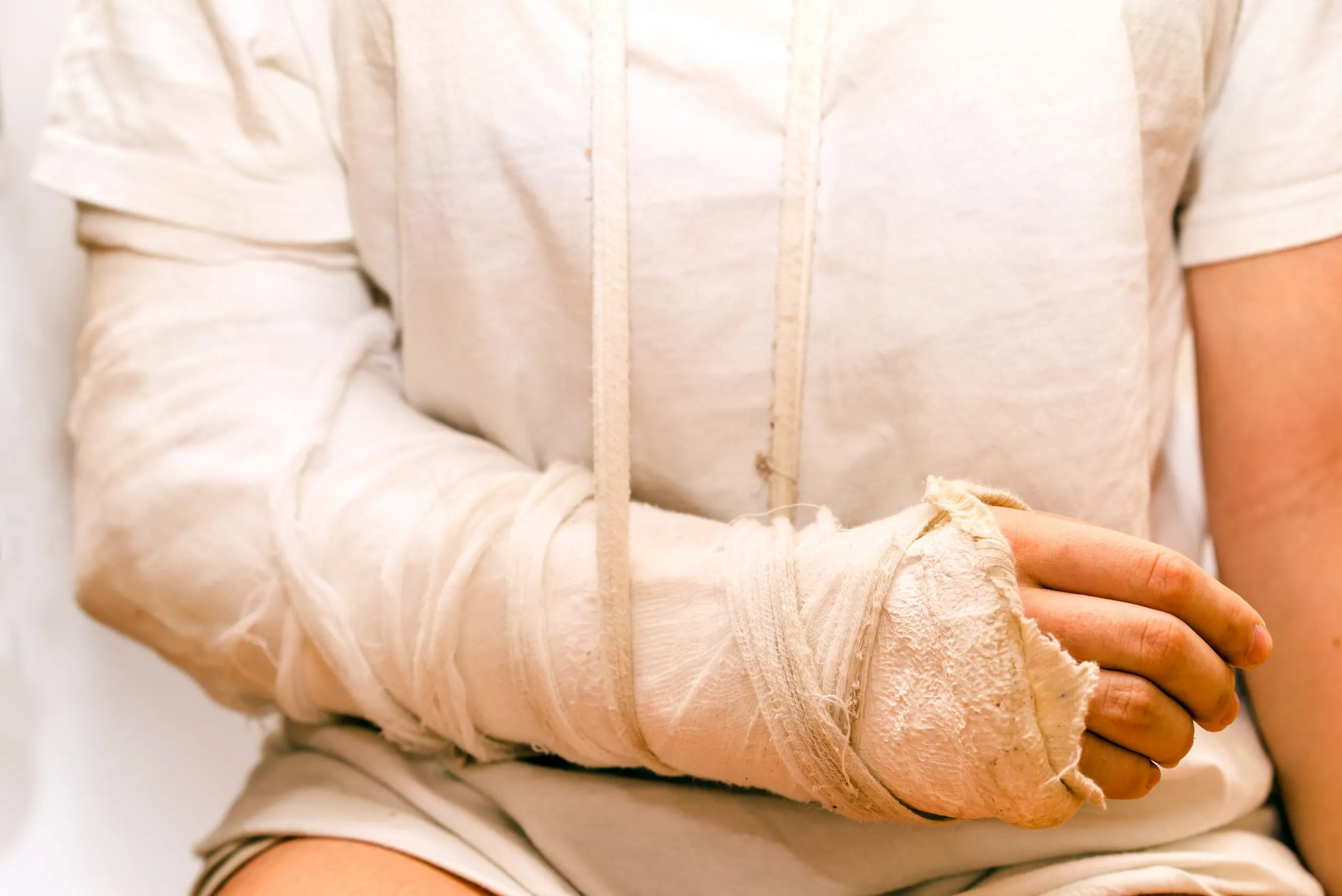 Broken arm in cast. If you’ve sustained an injury due to the negligent acts of others, our Kansas City personal injury lawyers are ready to fight for you.